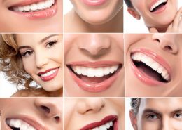 Estética dental