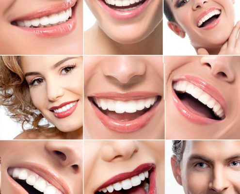 Estética dental
